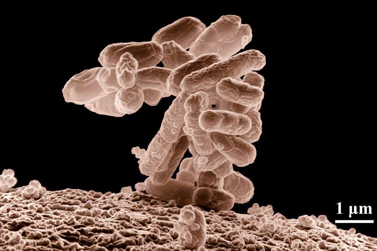 Escherichia coli