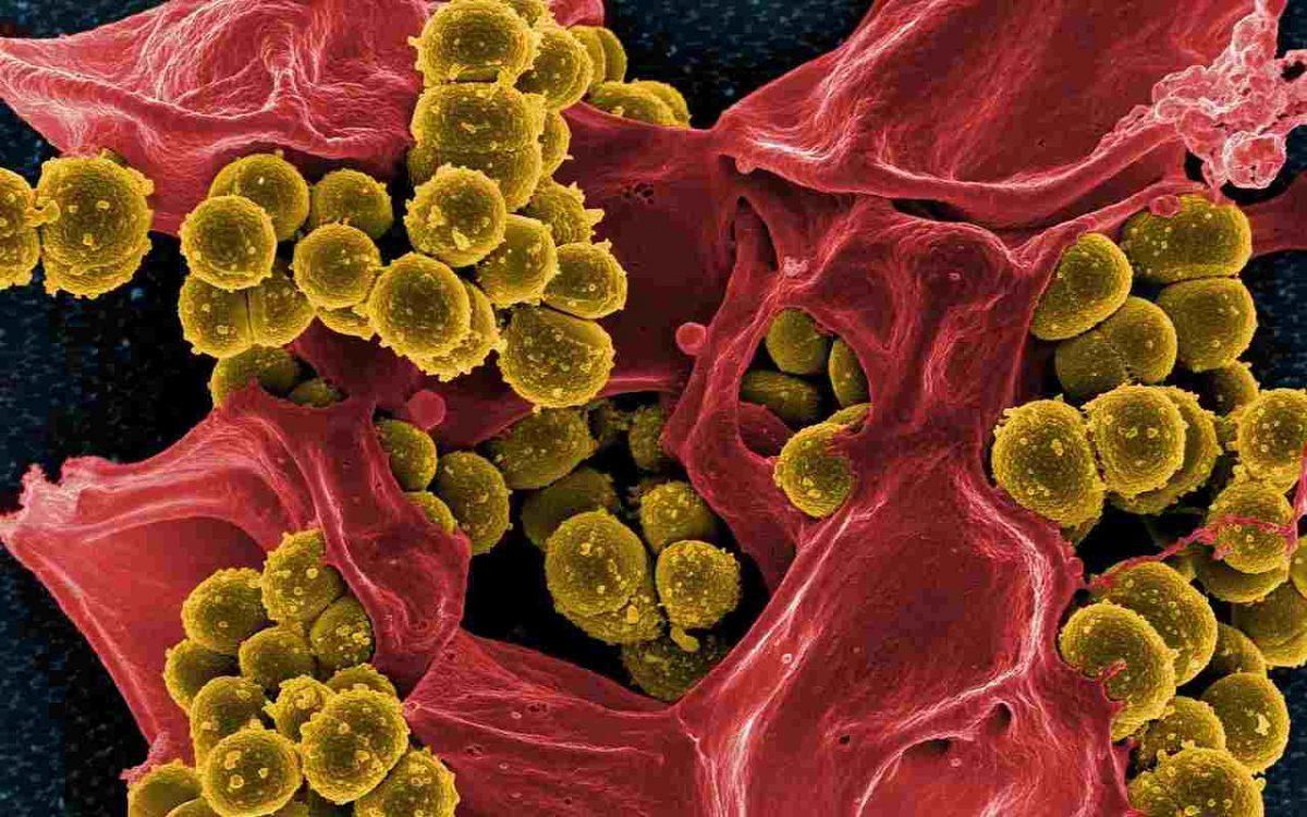Ureaplasma