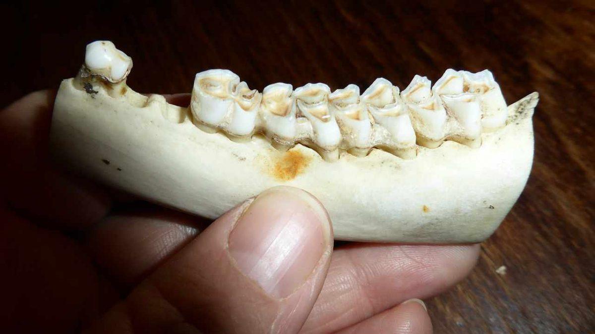 зъбен кариес