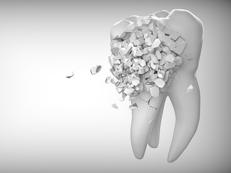 Ерозия на зъбите